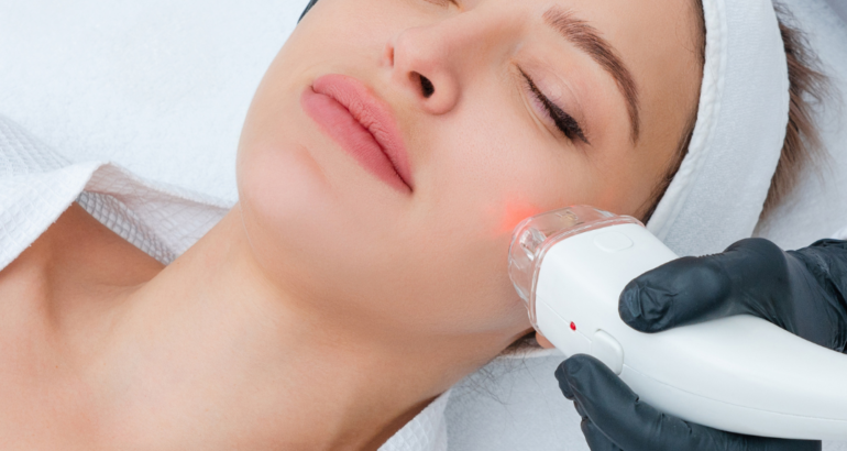 Laser Treatment